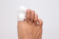 Symptoms of a Broken Toe